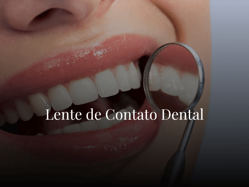 Lente de Contato Dental